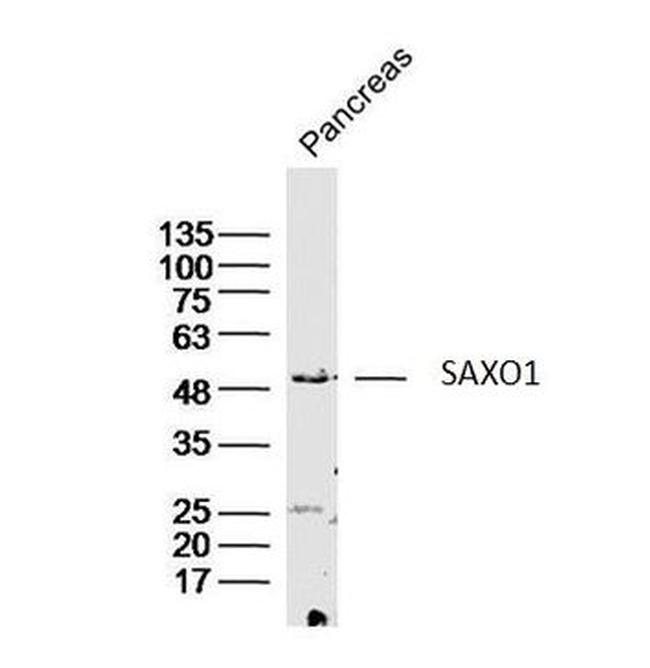 SAXO1 Antibody in Western Blot (WB)