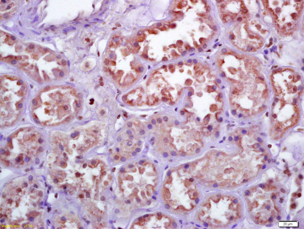 TXNRD1 Antibody in Immunohistochemistry (Paraffin) (IHC (P))