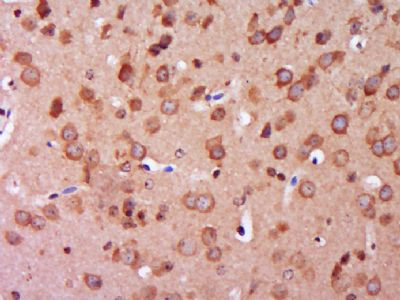 TXNRD1 Antibody in Immunohistochemistry (Paraffin) (IHC (P))