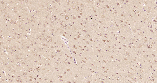 Peroxiredoxin 2 Antibody in Immunohistochemistry (Paraffin) (IHC (P))