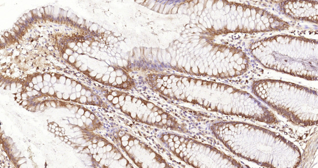 Peroxiredoxin 2 Antibody in Immunohistochemistry (Paraffin) (IHC (P))