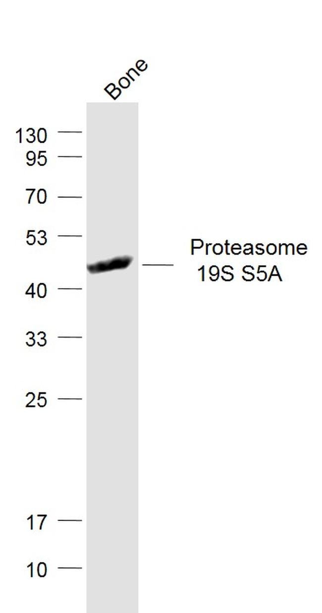 Proteasome 19S S5A Antibody in Western Blot (WB)