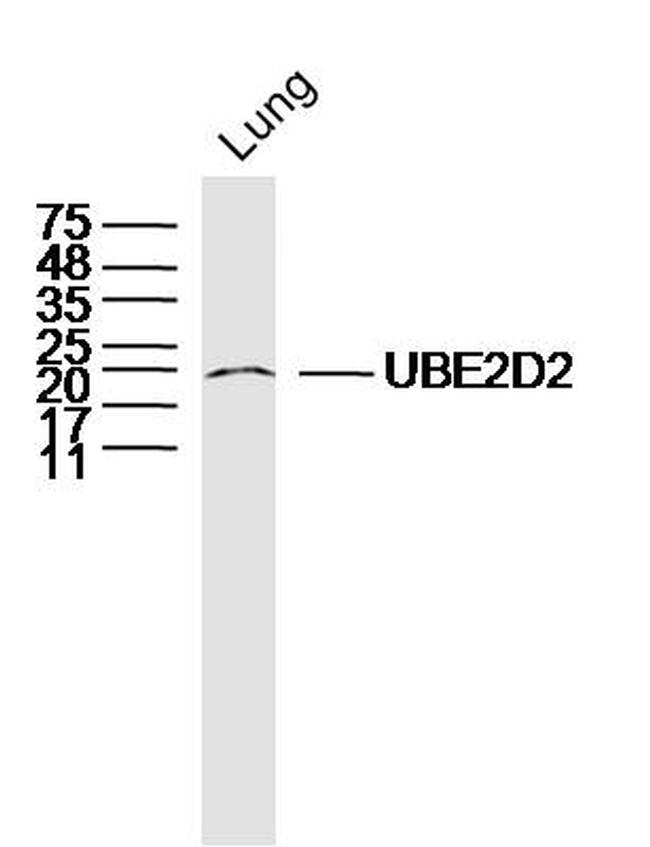 UBE2D2 Antibody in Western Blot (WB)