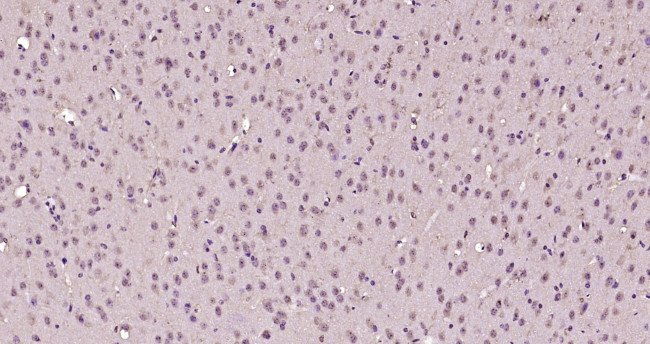 EGR2 Antibody in Immunohistochemistry (Paraffin) (IHC (P))