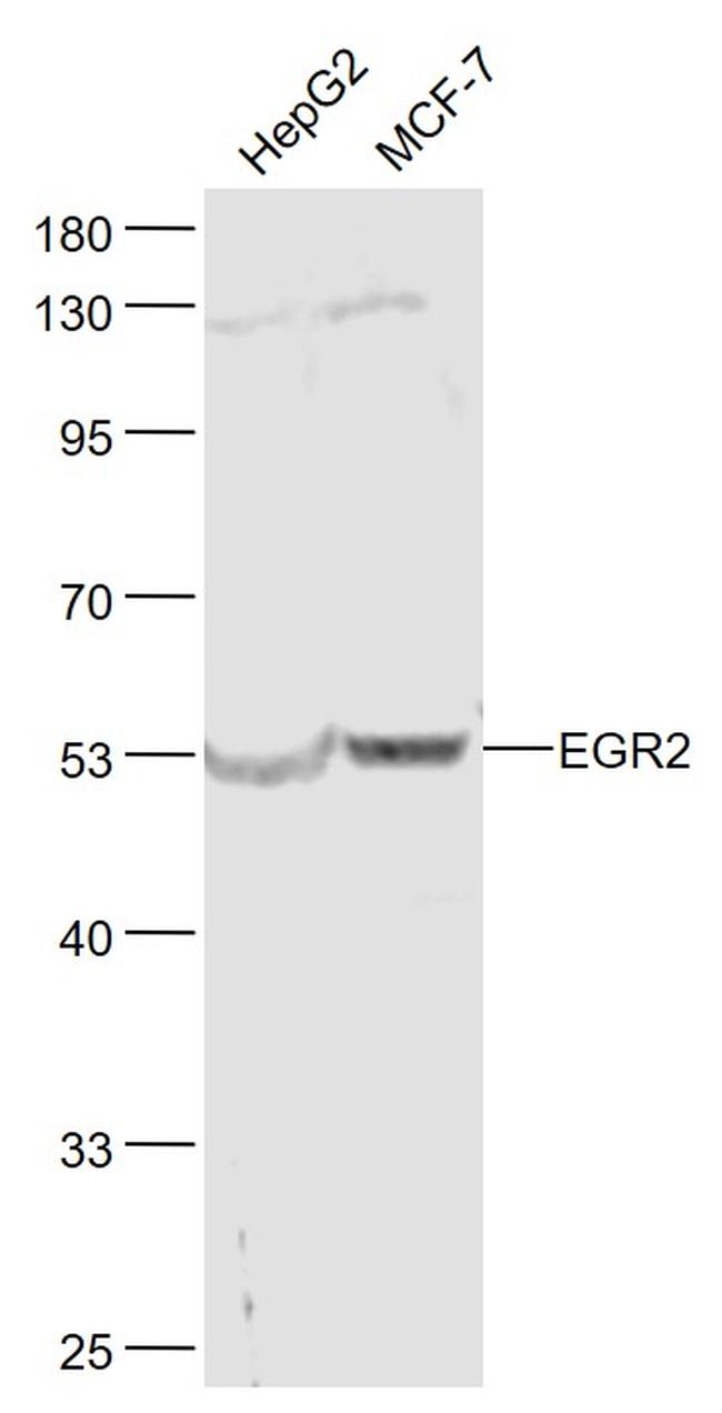 EGR2 Antibody in Western Blot (WB)