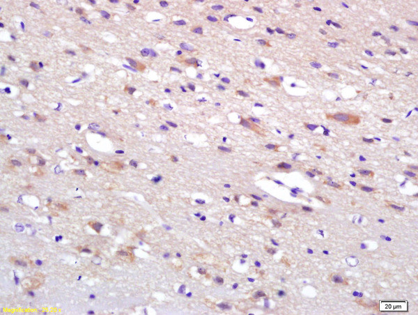 HIP2 Antibody in Immunohistochemistry (Paraffin) (IHC (P))