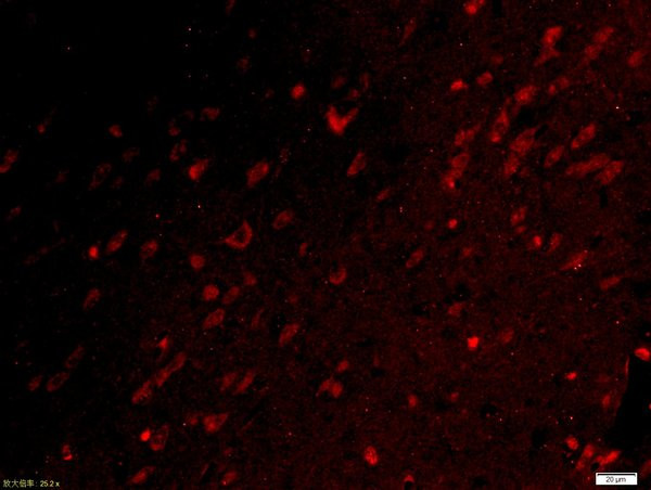 UBE2Q1 Antibody in Immunohistochemistry (Paraffin) (IHC (P))