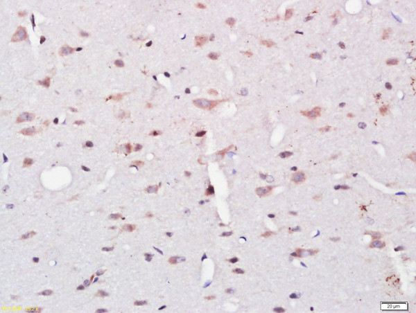 UBE2W Antibody in Immunohistochemistry (Paraffin) (IHC (P))