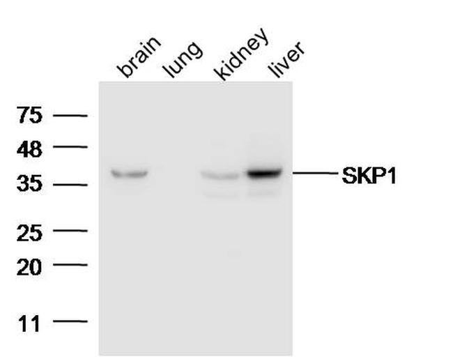 SKP1 Antibody in Western Blot (WB)