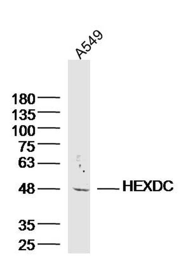 HEXDC Antibody in Western Blot (WB)