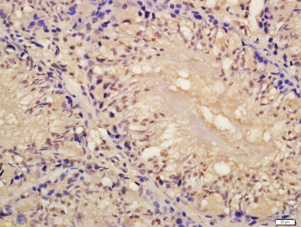 Lin28A/B Antibody in Immunohistochemistry (Paraffin) (IHC (P))