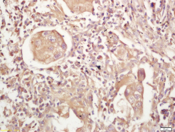 MHC Class 2 Antibody in Immunohistochemistry (Paraffin) (IHC (P))