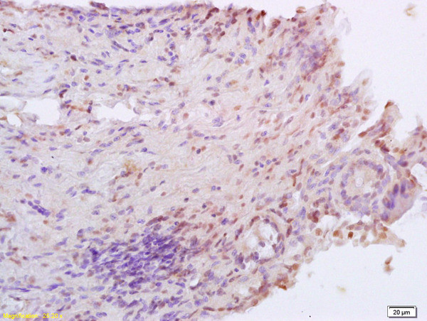 XRCC4 Antibody in Immunohistochemistry (Paraffin) (IHC (P))