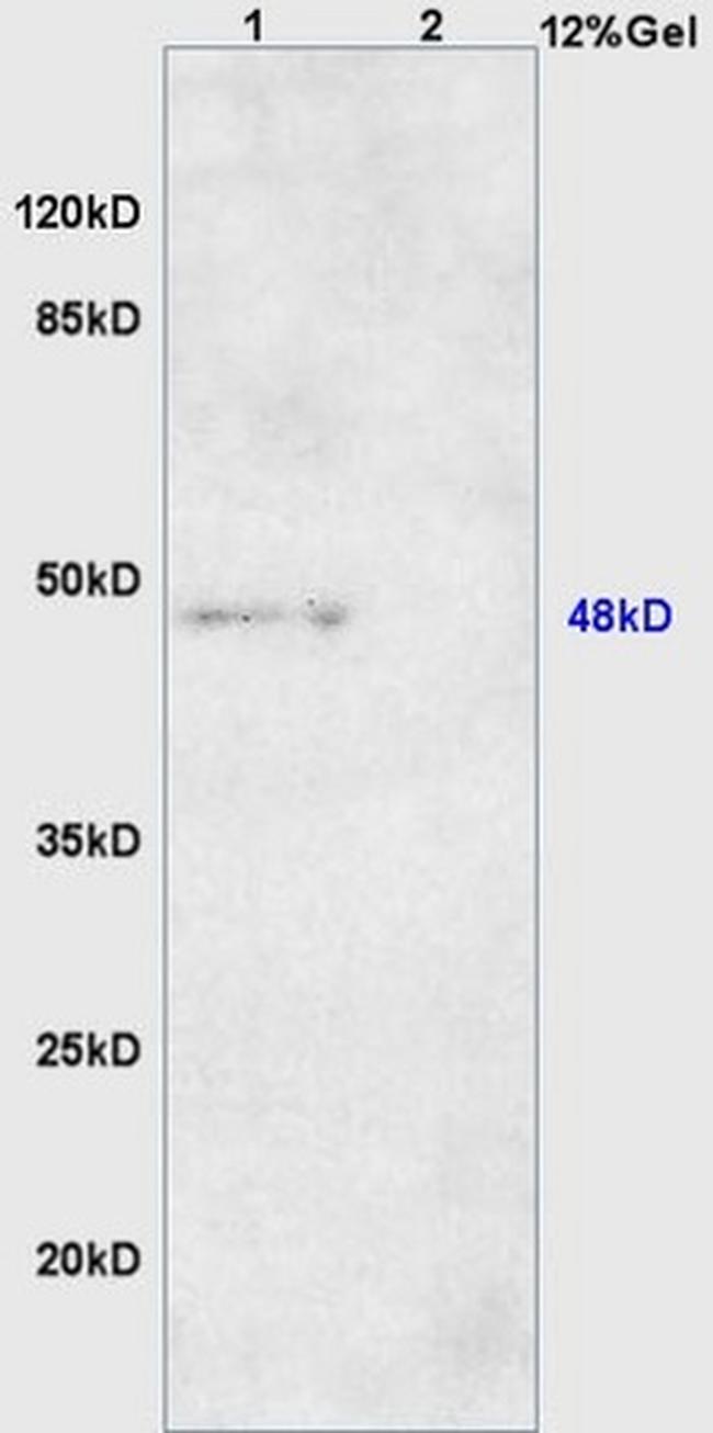 DNA Polymerase beta Antibody in Western Blot (WB)