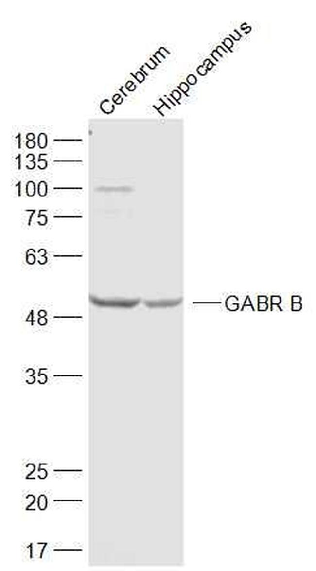 GABR B3 Antibody in Western Blot (WB)