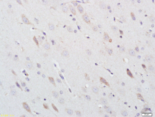 Nitrotyrosine Antibody in Immunohistochemistry (Paraffin) (IHC (P))