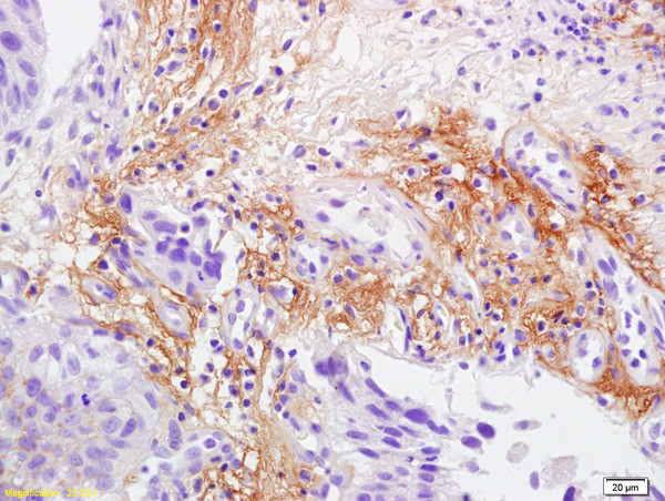 Laminin 2 alpha Antibody in Immunohistochemistry (Paraffin) (IHC (P))