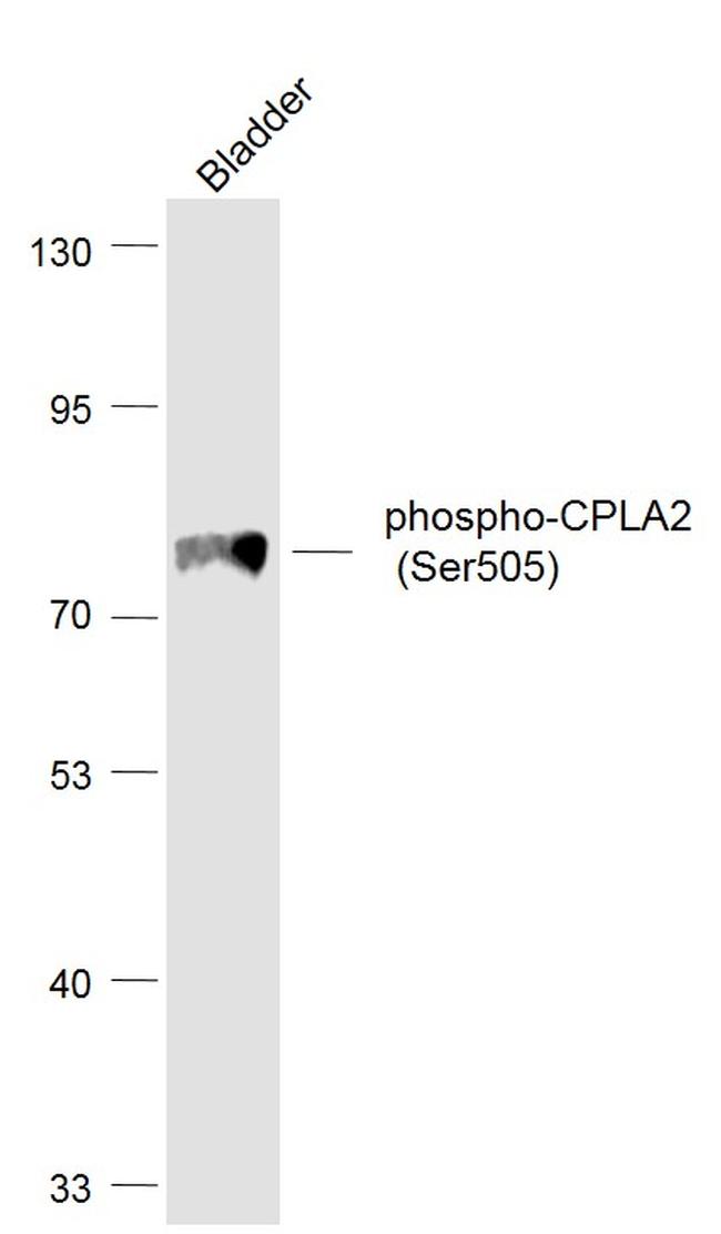 Phospho-CPLA2 (Ser505) Antibody in Western Blot (WB)