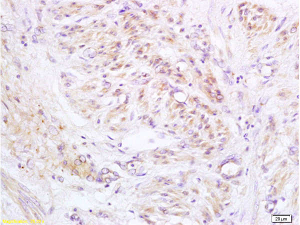 PXMP1 Antibody in Immunohistochemistry (Paraffin) (IHC (P))