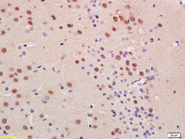 C9orf72 Antibody in Immunohistochemistry (Paraffin) (IHC (P))