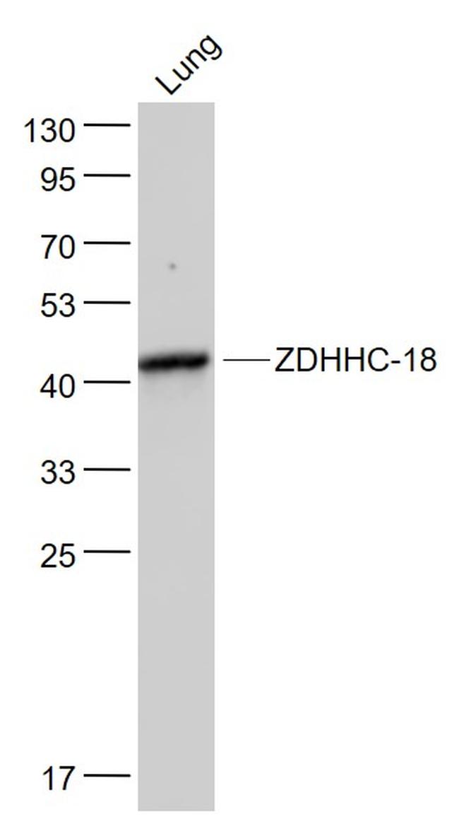 ZDHHC-18 Antibody in Western Blot (WB)