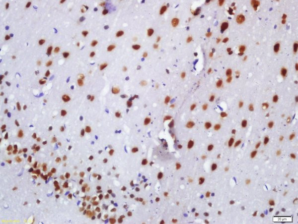 BASP1 Antibody in Immunohistochemistry (Paraffin) (IHC (P))