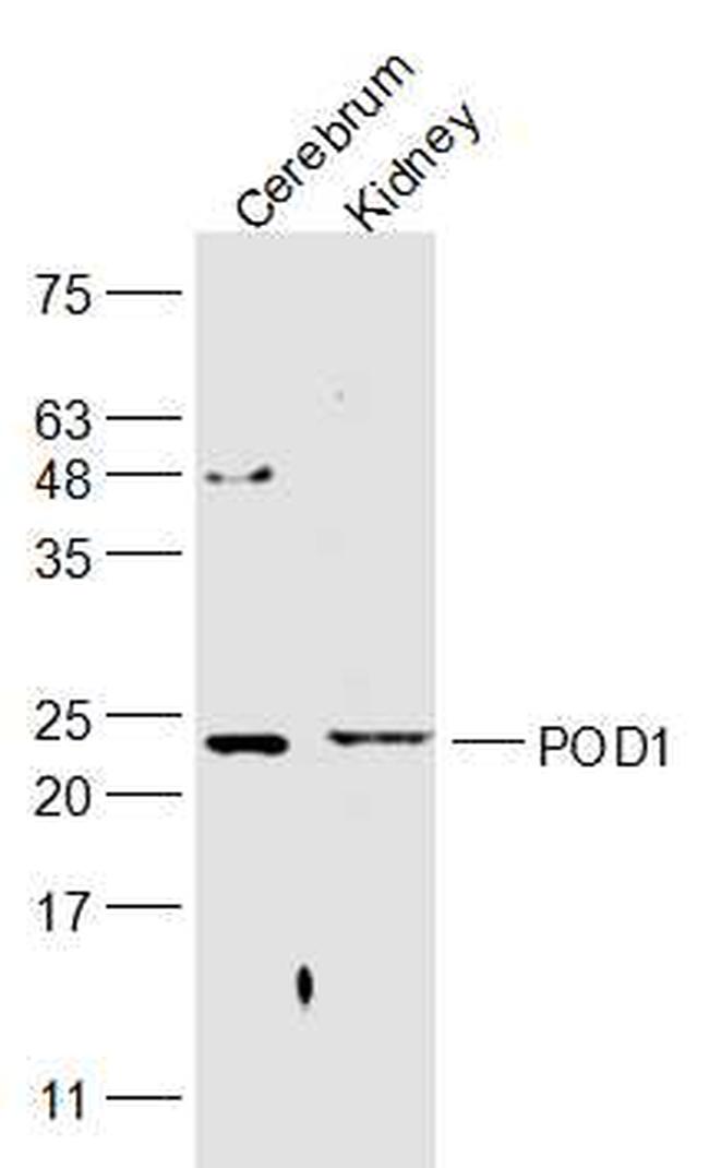 POD1 Antibody in Western Blot (WB)