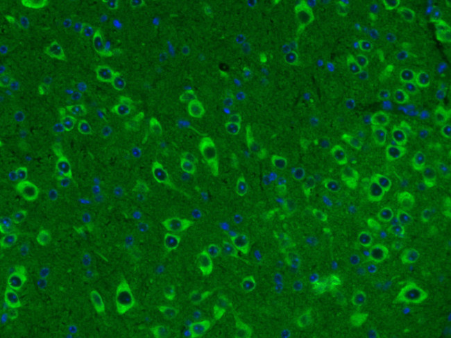 Somatostatin Antibody in Immunohistochemistry (Paraffin) (IHC (P))