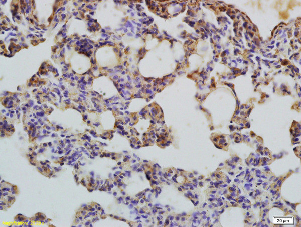 LC3 Antibody in Immunohistochemistry (Paraffin) (IHC (P))