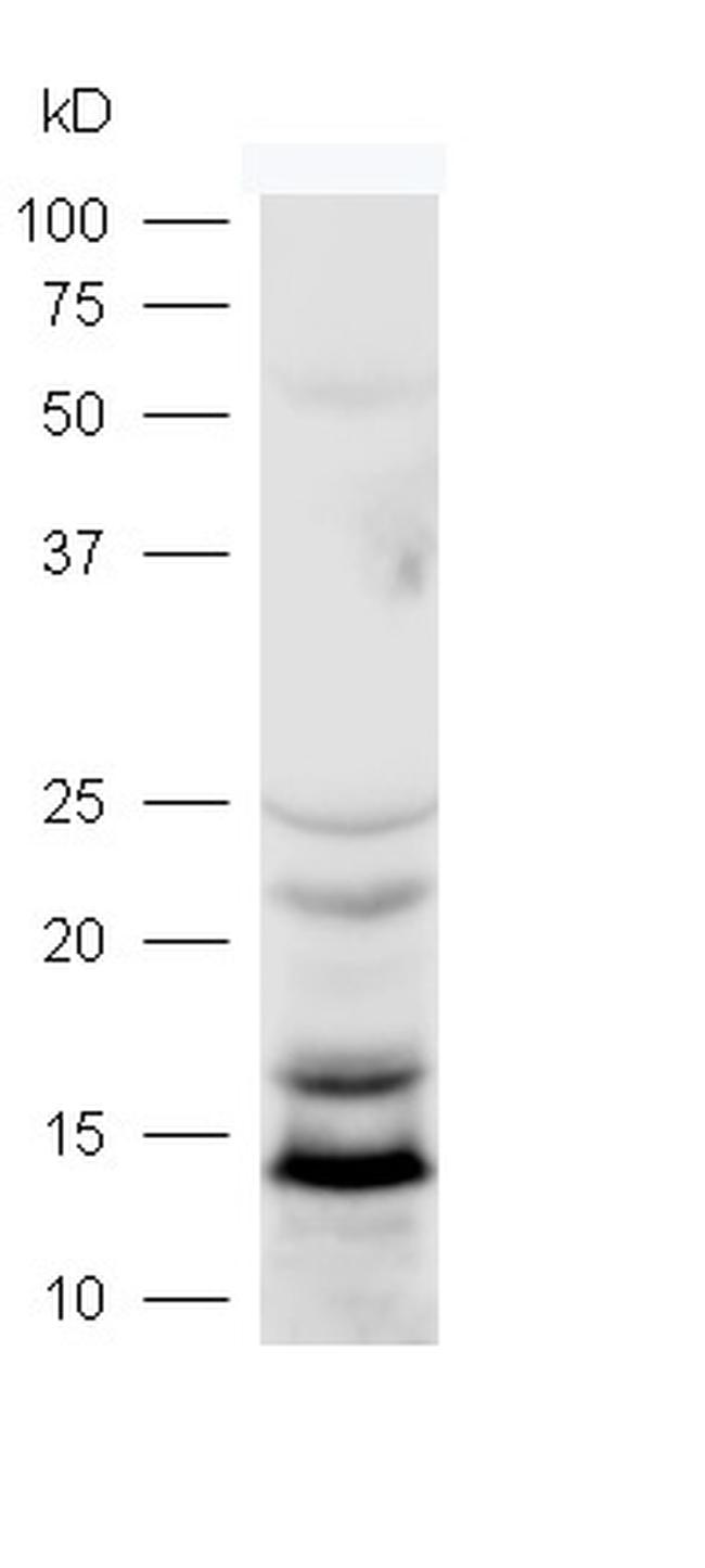 LC3 Antibody in Western Blot (WB)