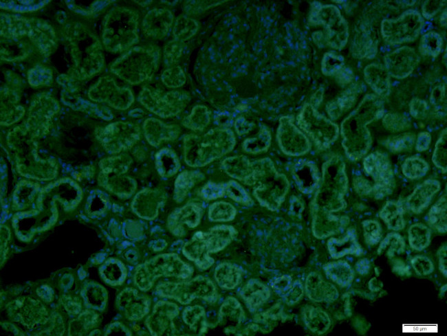 CECR1 Antibody in Immunohistochemistry (Paraffin) (IHC (P))