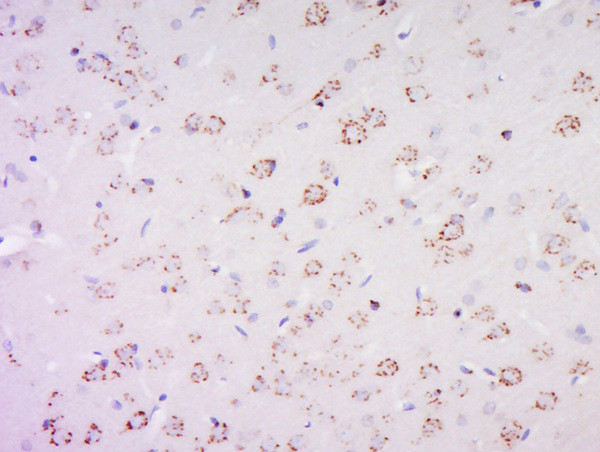 PAS1C1 Antibody in Immunohistochemistry (Paraffin) (IHC (P))