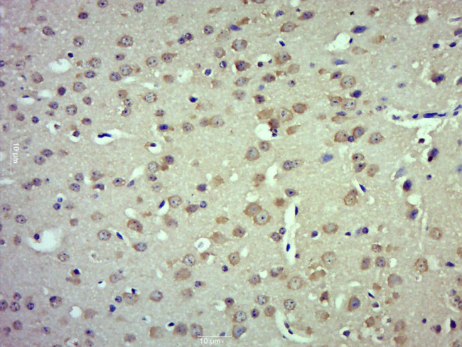 TRPM4 Antibody in Immunohistochemistry (Paraffin) (IHC (P))