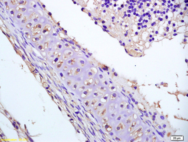 Phospho-DVL2 (Thr224) Antibody in Immunohistochemistry (Paraffin) (IHC (P))