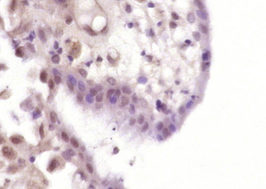 CDX2/3 Antibody in Immunohistochemistry (Paraffin) (IHC (P))