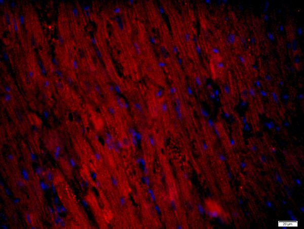 RNF169 Antibody in Immunohistochemistry (Paraffin) (IHC (P))