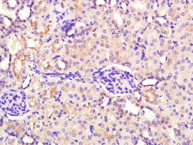 MUL1 Antibody in Immunohistochemistry (Paraffin) (IHC (P))