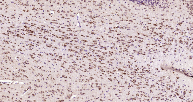 ACPL2 Antibody in Immunohistochemistry (Paraffin) (IHC (P))