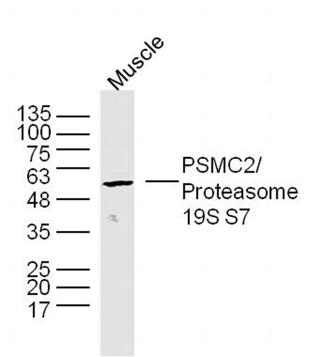 Proteasome 19S S7 Antibody in Western Blot (WB)