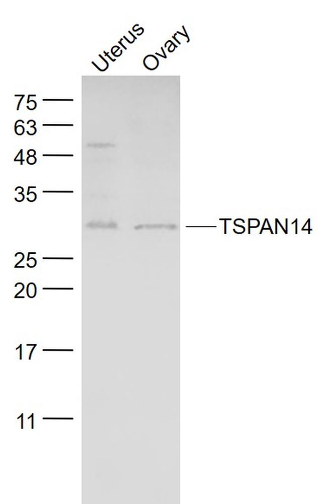 TSPAN14 Antibody in Western Blot (WB)