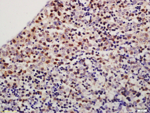 TXNDC9 Antibody in Immunohistochemistry (Paraffin) (IHC (P))