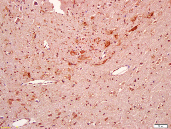 BBS5 Antibody in Immunohistochemistry (Paraffin) (IHC (P))