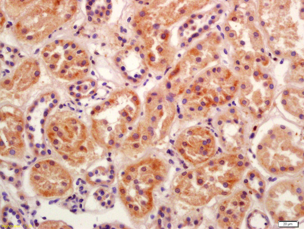 BBS5 Antibody in Immunohistochemistry (Paraffin) (IHC (P))