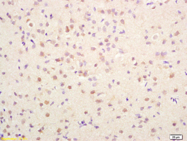 AMPK gamma 1/2/3 Antibody in Immunohistochemistry (Paraffin) (IHC (P))