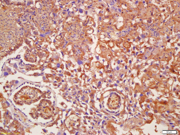 AMPK gamma 1/2/3 Antibody in Immunohistochemistry (Paraffin) (IHC (P))