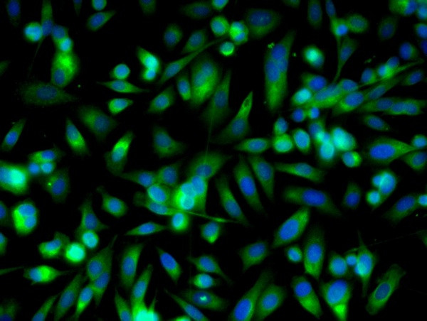 SIRT5 Antibody in Immunocytochemistry (ICC/IF)