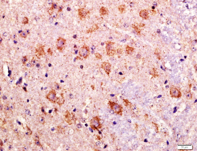 LAGY Antibody in Immunohistochemistry (Paraffin) (IHC (P))