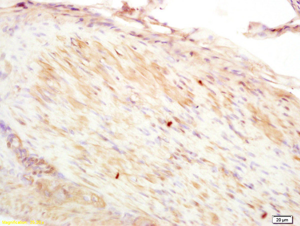 CNN2 Antibody in Immunohistochemistry (Paraffin) (IHC (P))