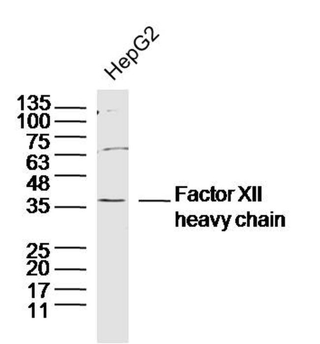 Factor 12 heavy chain Antibody in Western Blot (WB)