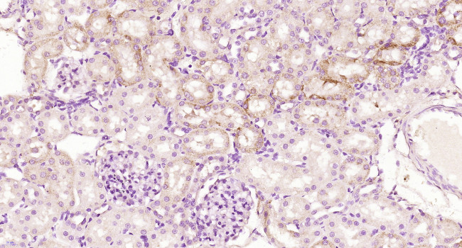 Kininogen-1 light chain Antibody in Immunohistochemistry (Paraffin) (IHC (P))